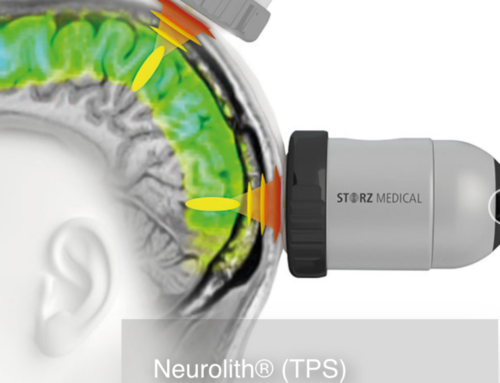 TPS Alzheimer Tedavisi